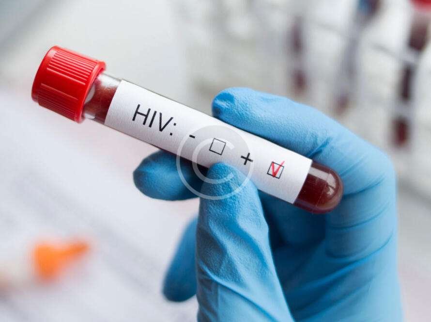 HIV test bottle reading positive