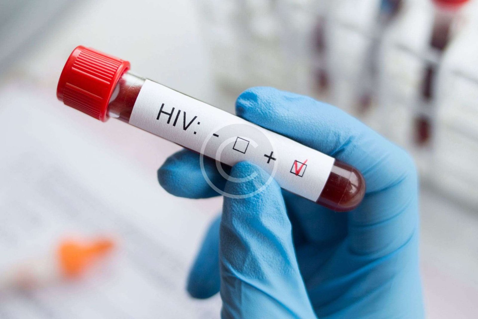 HIV test bottle reading positive