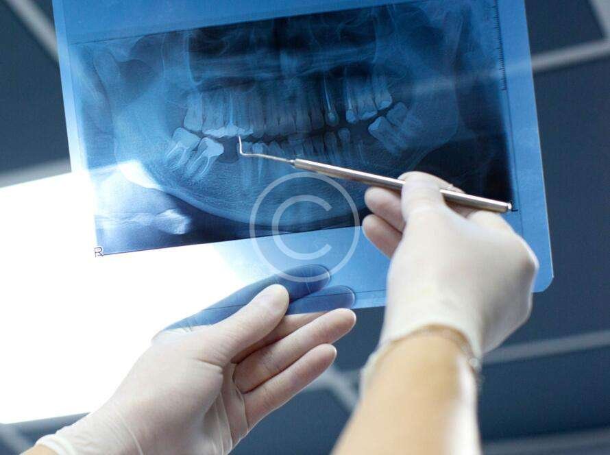 Dentist analyzing a patient's dental X-ray image