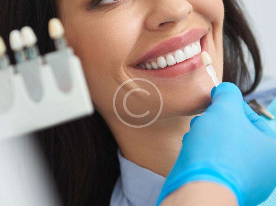 Female patient undergoing teeth-whitening treatment by a dentist