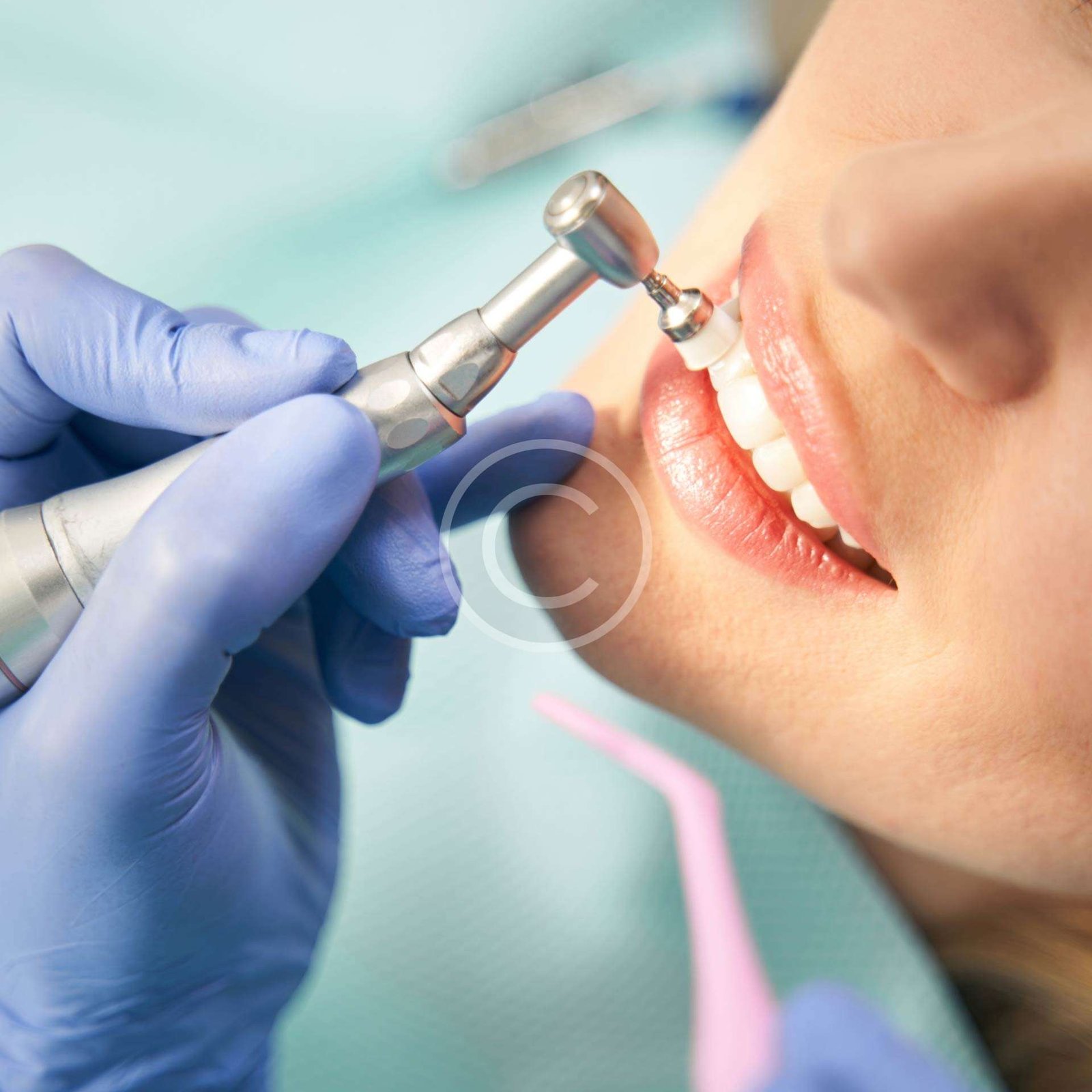Woman receiving teeth-whitening treatment from a dentist