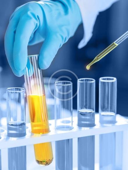 Scientist holding a flask with yellow liquid